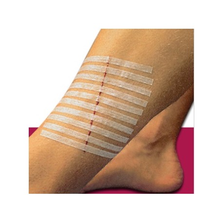 Sutures cutanées adhésives Steri-Strip 3M